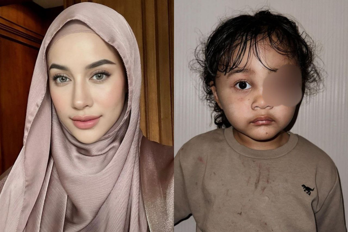 Siapa Baby Sitter Aghnia Punjabi yang Aniaya Anaknya hingga Kondisi Memar, Lebam Sampai Beberapa Luka Lecet