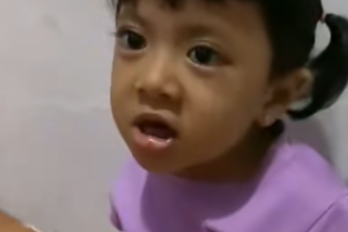 Osteogenesis Imperfekta Penyakit Apa? Inilah Kondisi yang Dialami Zehan Almira Alias Zeze Bocah Kecil yang Viral Karena Lancar Berbicara Bahasa Sunda