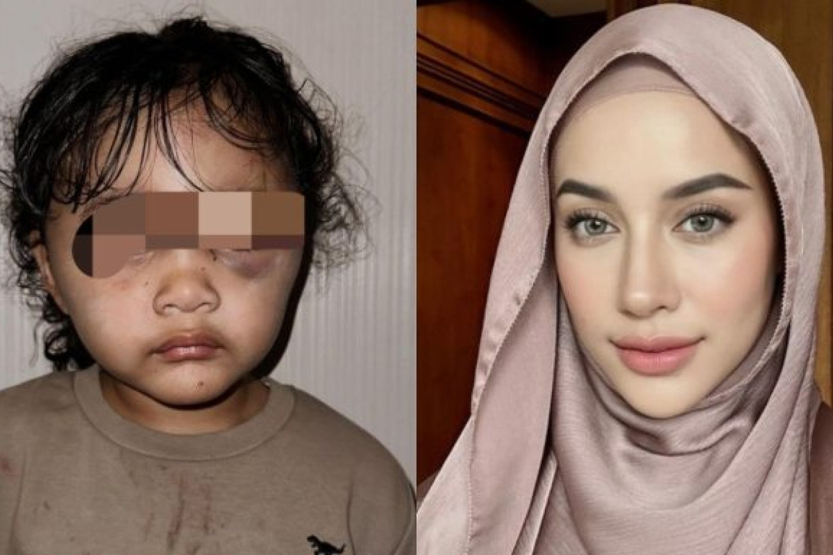 Wajah Anak Aghnia Punjabi Jadi Bulan-Bulanan Pengasuh, Kabel Kipas dan Gigitan Serangga Jadi Alibinya, Kini Tersangka Diseret Pihak Kepolisian