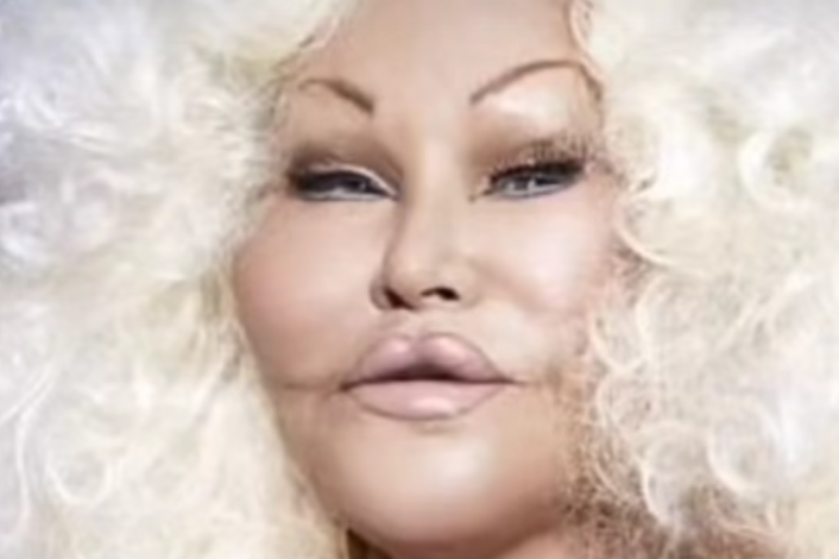 Apa Penyebab Jocelyn Wildenstein Sosialita yang Dijuluki Catwomen Meninggal Dunia? Inilah Kronologi Kematian Ratu Oplas Amerika yang Tewas Jelang Tahun Baru 2025