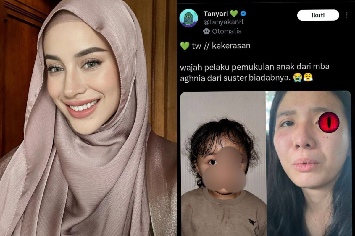 Wajah Anak Memar Akibat Siksaan Bertubi-Tubi, Aghnia Punjabi Laporkan Pengasuh ke Pihak Kepolisian, Pelaku Berhasil Diamankan