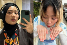 Anak Ridwan Kamil Rambut Pirang, Potret Terbaru Camillia Azzahra Semir Blonde Sita Perhatian Warganet, Begini Tanggapan Santainya