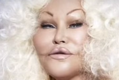 Apa Penyebab Jocelyn Wildenstein Sosialita yang Dijuluki Catwomen Meninggal Dunia? Inilah Kronologi Kematian Ratu Oplas Amerika yang Tewas Jelang Tahun Baru 2025